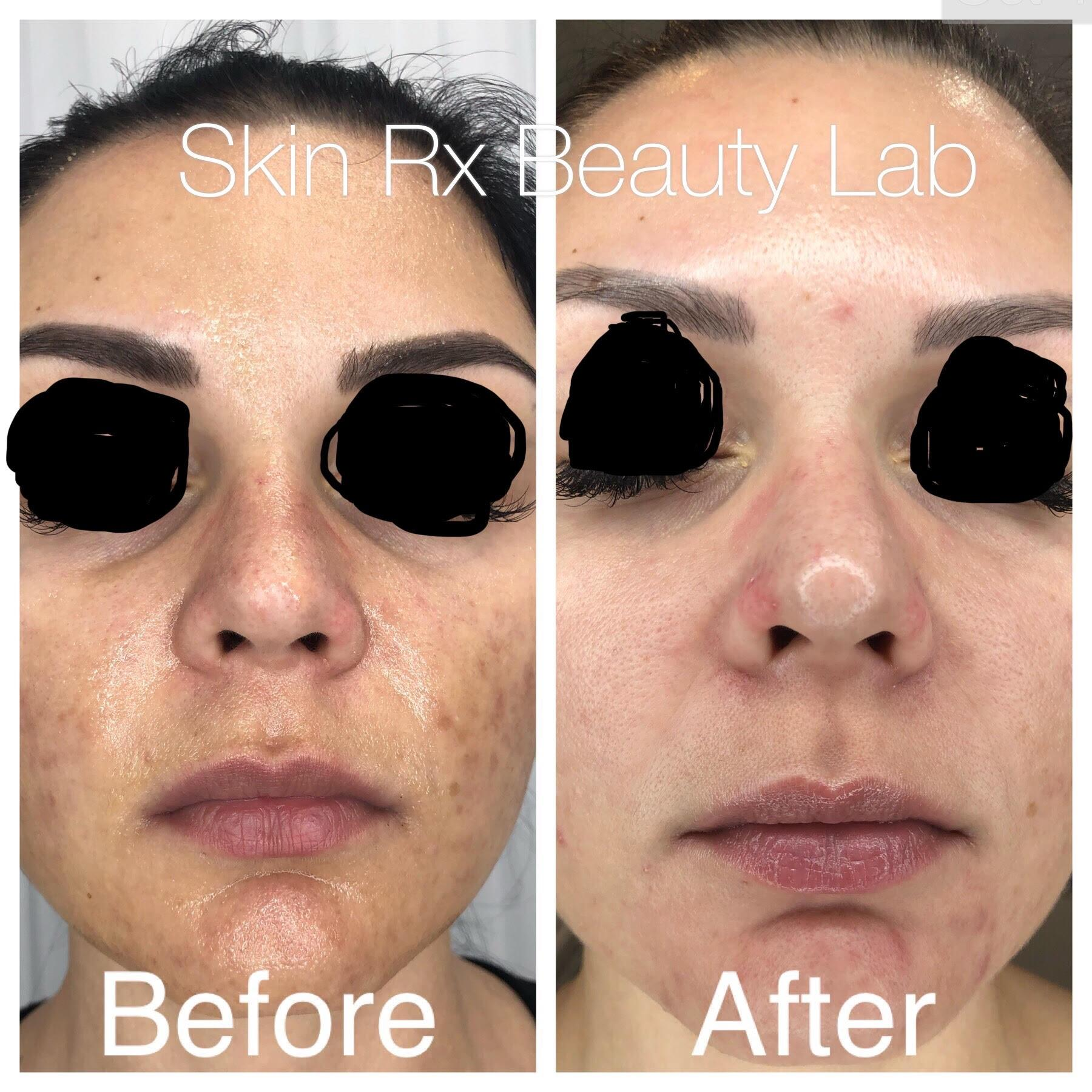 Beautiful Skin Rx